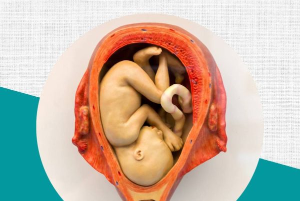 Title: Placenta Previa: Is Vaginal Birth Still An Option?