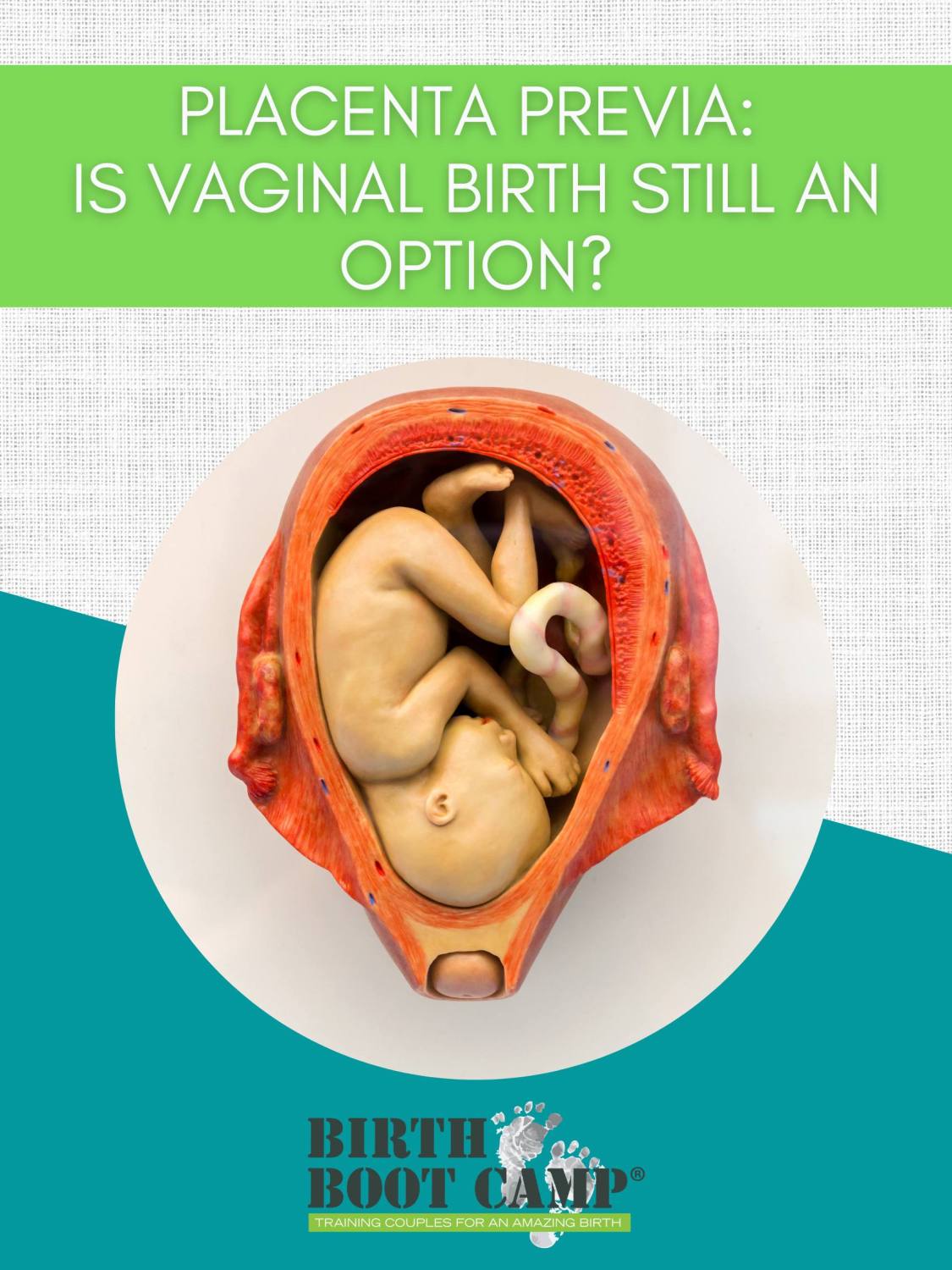 Placenta Previa: Is Vaginal Birth Still an Option?